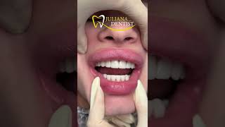 Вишукана робота лікаря Бараник Анастасії😍 #dentist #dentalclinic #dnipro #ukraine