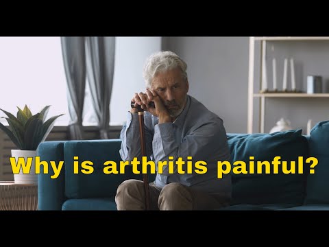 Video: Kada artrito skausmas stiprėja?