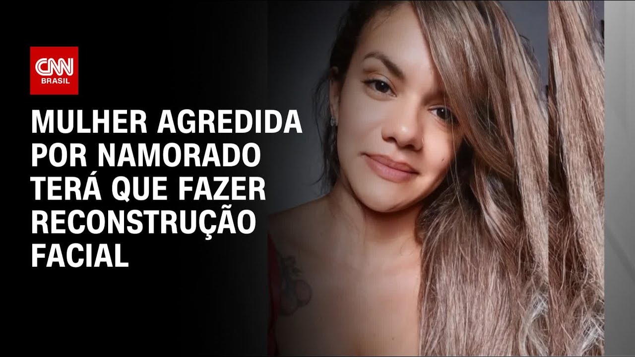 Mulher que levou 60 socos do namorado terá que fazer reconstrução facial | CNN NOVO DIA