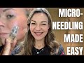 Easy and effective diy microneedling device  qure microinfusion facial system review
