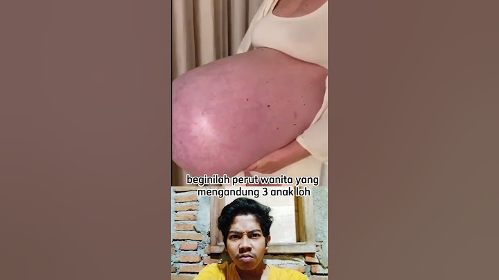 begini perut gantung ibu hamil yang mengerikan #shorts #reaction #ibuhamil #dokter