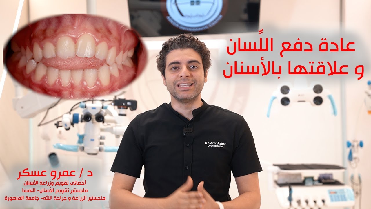 دقيقة تقويم أسنان، عادات الأسنان الخاطئة و علاقتها بتقويم الأسنان عادة دفع اللسان tongue thrust
