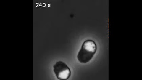 Crawling C. elegans sperm