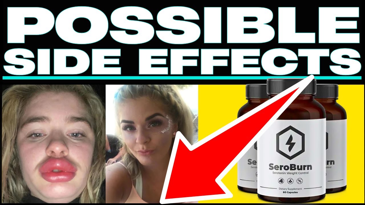 (😱❌BEWARE⛔🙀Get Your FREE Bottle Of SeroBurn? #seroburncom #seroburnreviews #seroburn #seroburnreview