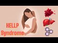 HELLP Syndrome Updated 2023 CRASH Medical Review Series HELLP Syndrome Updated 2023 CRASH Medical Review Series