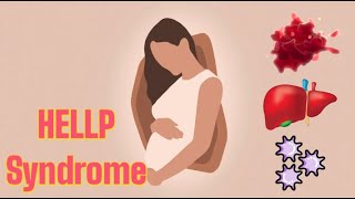 HELLP Syndrome (updated 2023) - CRASH! Medical Review Series