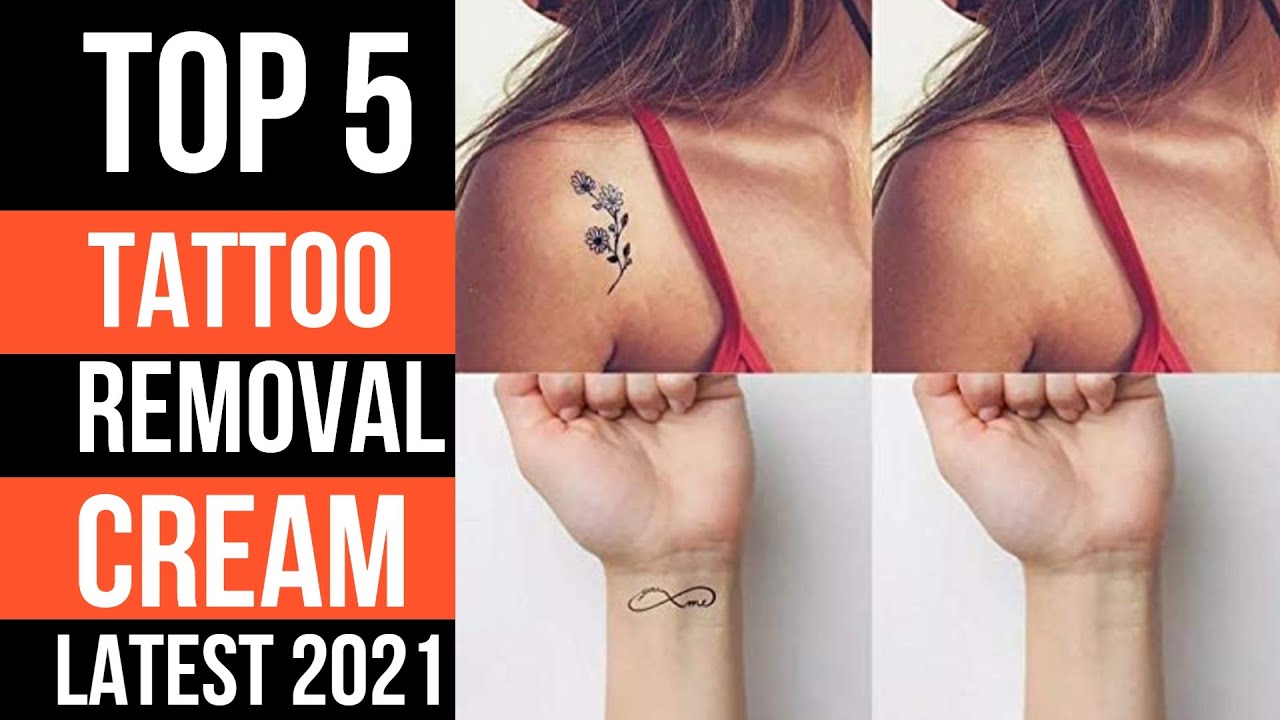 Learn 93+ about best tattoo removal cream super cool .vn
