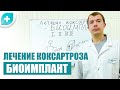 Лечение коксартроза биоимплант bio-osteo