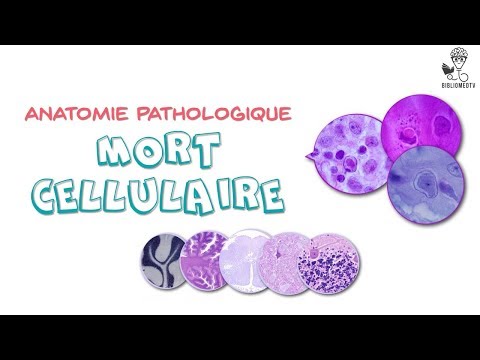 Vidéo: Molécules Et Biomarqueurs Liés à La Mort Cellulaire Pour Le Traitement Ciblé Du Carcinome à Cellules Rénales