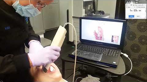 3 Shape Trios - 3 Scan OSGB