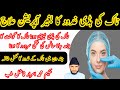 Naak Ki Haddi Ka Barh Jana Ilaaj Nose Bone Increase Treatment Without Operation HIKMAT E SABIR Naak Ki Haddi Ka Barh Jana Ilaaj Nose Bone Increase Treatment Without Operation HIKMAT E SABIR