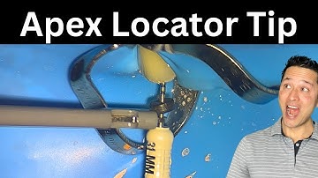 "My Apex Locator Isn