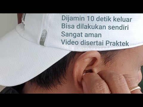 Cara mengeluarkan Kapas atau Cotton Bud dalam Telinga