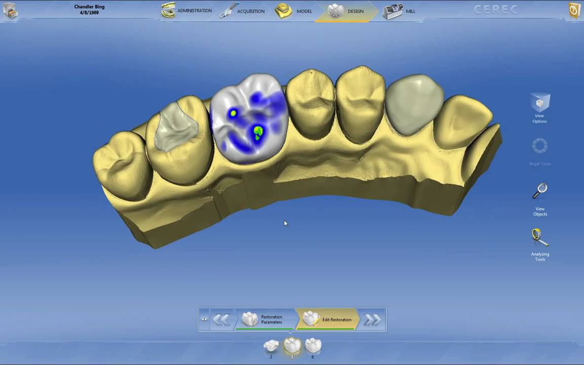 CEREC 4.0: Introduction - YouTube