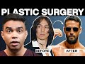 Tiger Shroff's Cosmetic Surgery Secrets REVEALED by a Plastic Surgeon
