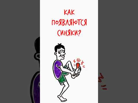 КАК появляются СИНЯКИ? #шортс