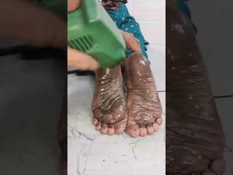Reflexology Therapy!! Detox foot 👣 massage therapy video!! Reflexology Therapy Benefits!! #live