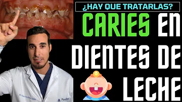 ¿Qué ocurre si no se trata la caries infantil?