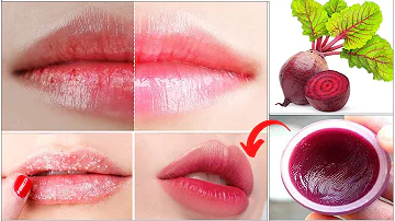 Get Baby Soft and Pink Lips Naturally at Home | Make Your Own Lip Balm for Soft Pink Lips -100% Work