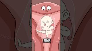 What Causes Xyy Syndrome?