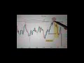 Yeh tha SMC Series Part-4 displacement. #smartmoneyconcepts#viral #forextrading#trader