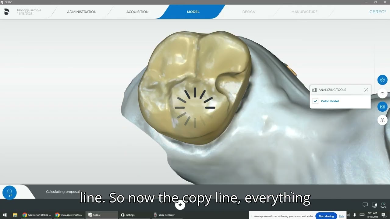 CEREC BioCopy (No Opposing, No Bite)