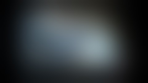 Xive - Immediate loading in the edentulous mandible