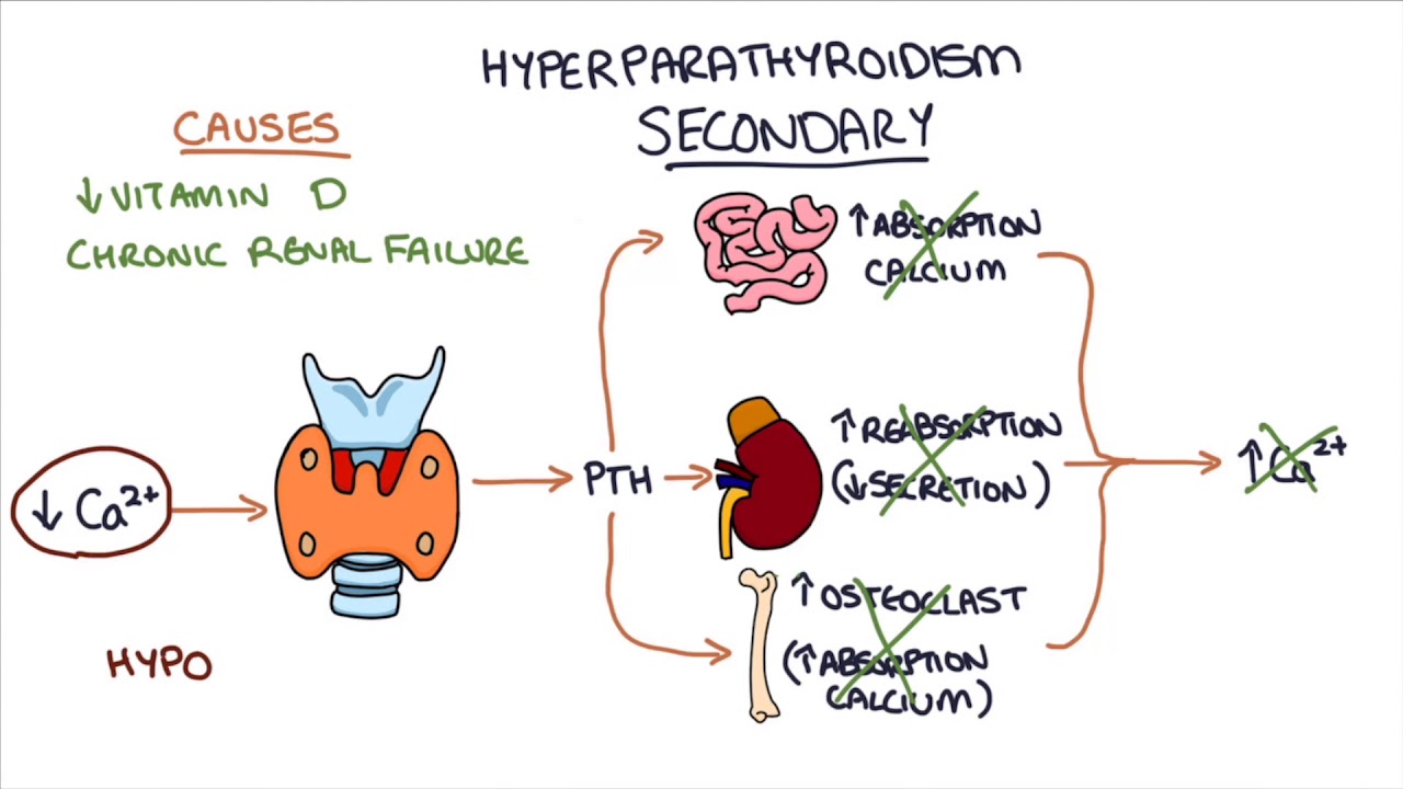 hyperparathyroidism and hypoparathyroidism