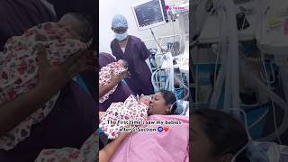 C-Section Delivery Of My Twins The Moment I Saw Them For The First Time