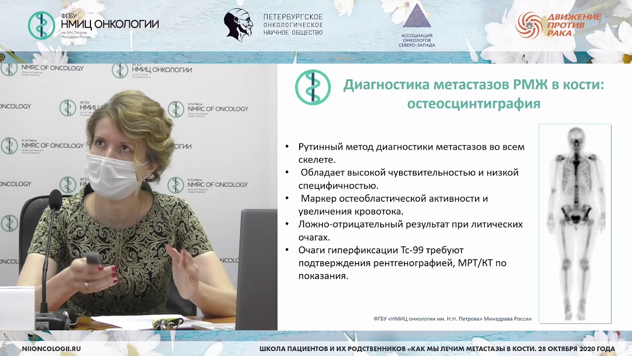 Остеомодифицирующие агенты при метастазах в кости на страже костной ...