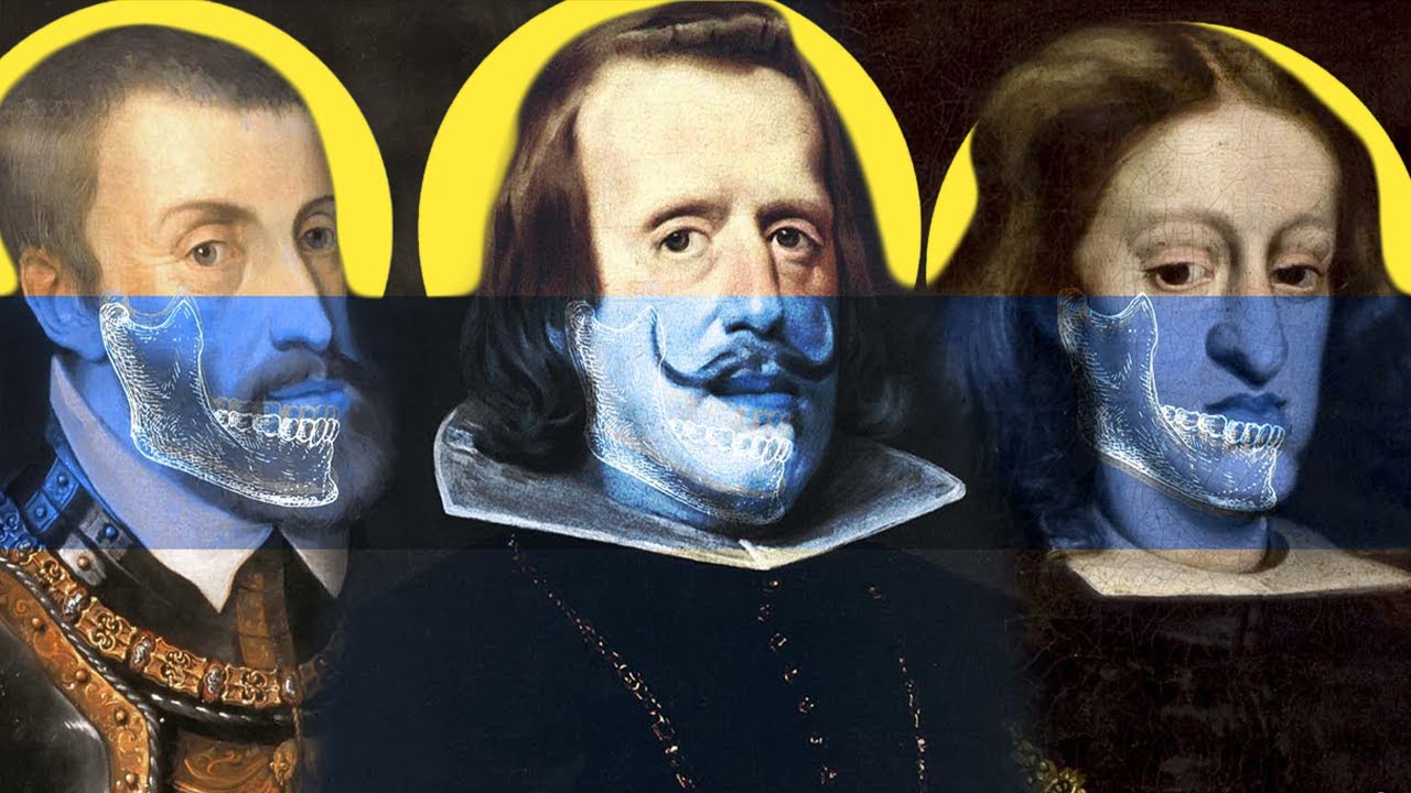 The Habsburg Jaw: The Royal Deformity Caused By Centuries Of Incest