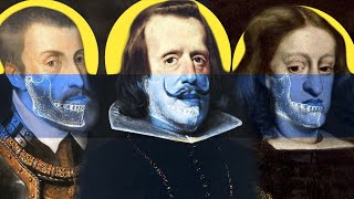 The Habsburg Jaw and the Dark Side of Royalty