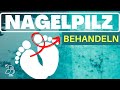 🚀NAGELPILZ NATÜRLICH BEHANDELN🚀 12 Hausmitel gegen Nagelpilz. Nagelpilz Behandlung leicht gemacht