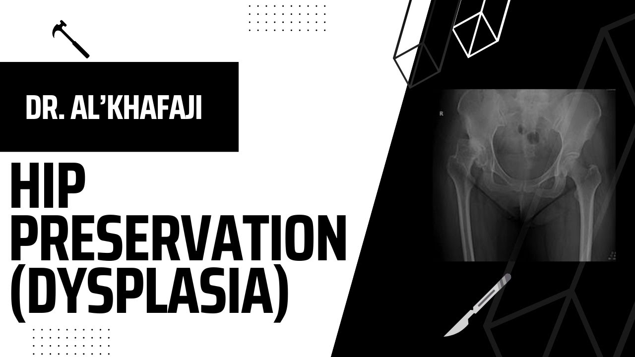 104: Hip Preservation w/Dr. Al Khafaji - YouTube