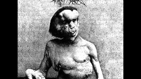 Nykuist - The Malformation (2011) - 2 - Memories Of Mainländer