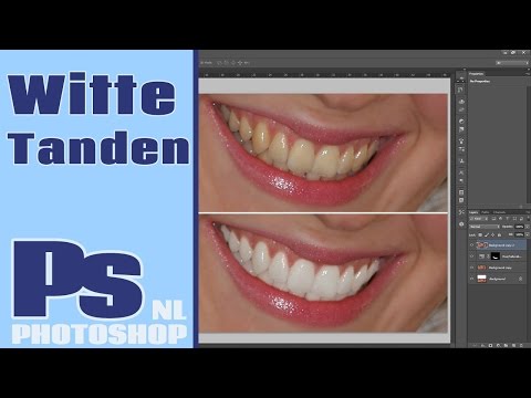 Video: Hoe Tanden Witter Te Maken In Photoshop