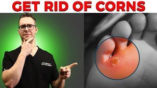 Calluses, Foot Corns & Plantar Wart Removal [Top 10 Home Remedies] screenshot 1