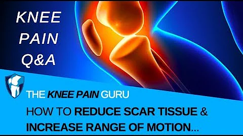 Knee Scar Tissue l How to Reduce Knee Scar Tissue & Increase Flexibility/Range of Motion?