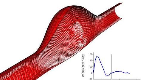 FSI in an in-vitro abdominal aortic aneurysm