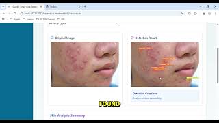 GlowSee App Demo | Detect 6 Types of Acne with AI + Personalized Skincare screenshot 1