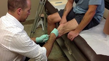 The Casting Procedure | limb-loss.org