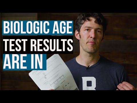 MyDNAage Test Result Review (I&rsquo;m older than my actual age)