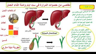 مش دكتورة ولكن - تخلصي من حصوات المرارة في ست ايام وامنة اثناء الحمل  (بعد اول ثلاث شهور حمل