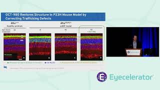 Octant: Next Generation Retina Therapeutics and Advances in AI Showcase