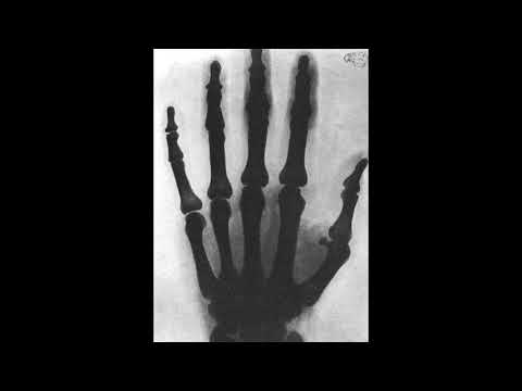 ტესლას 5 გიჟური გამოგონება