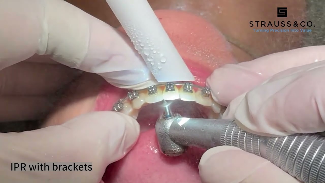 J316 IPR Diamond Bur Clinical Demonstration by Strauss & Co.