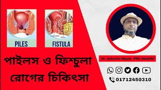 Treatment For Piles And Fistula L Positive Homeopathy Dr. Ashraful Haque, P, Health