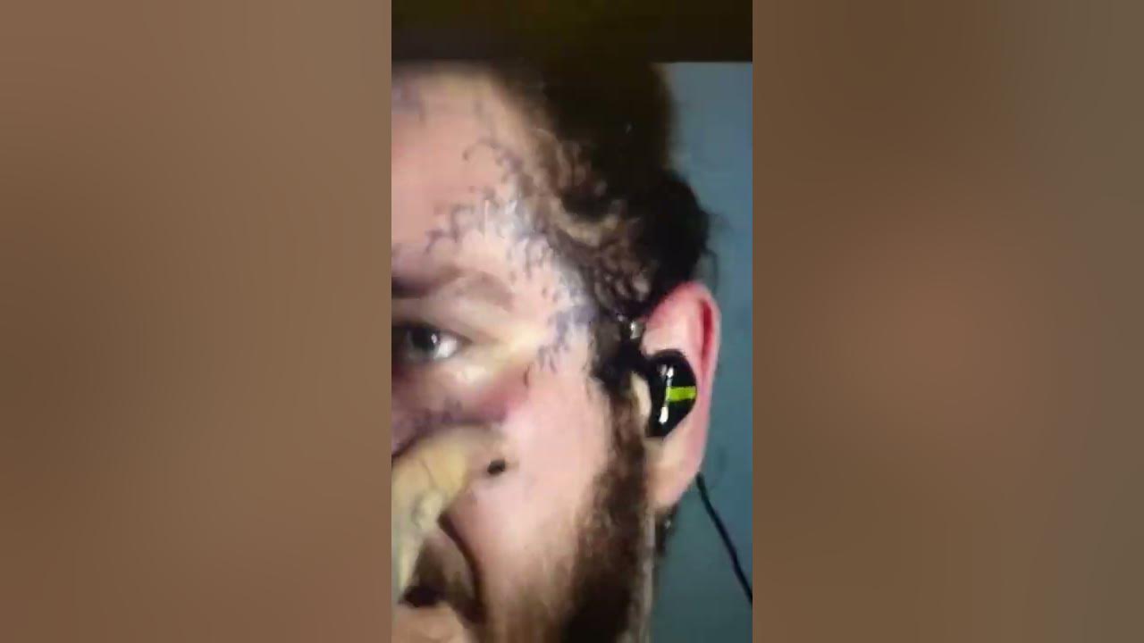 Post Malone- Over Now - (DJ Party)