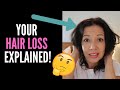 HAIR LOSS SUFFERER EXPLAINS TELOGEN EFFLUVIUM VS ANDROGENETIC ALOPECIA BASICS + DERMATOLOGY VISITS