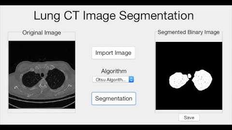 Lung CT Image Segmentation​ by Otsu Algorithm